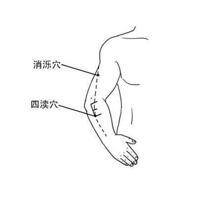 消濼穴→治頭痛、頸項(xiàng)強(qiáng)痛