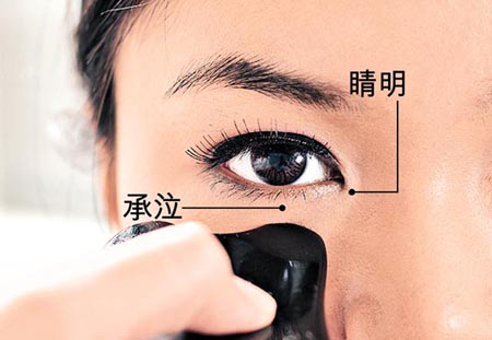 睛明穴→瀉熱明目