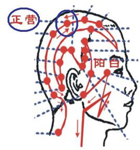正營穴→治頭痛、頭暈