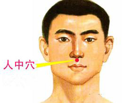 水溝穴→治昏迷、暈厥