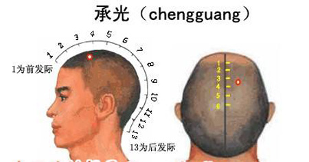 承光穴→治頭痛、鼻炎
