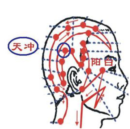 天沖穴→治頭痛、齒痛