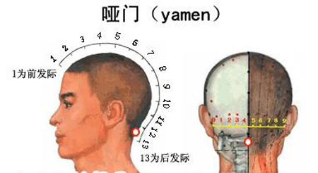 啞門穴→治音啞、頭痛