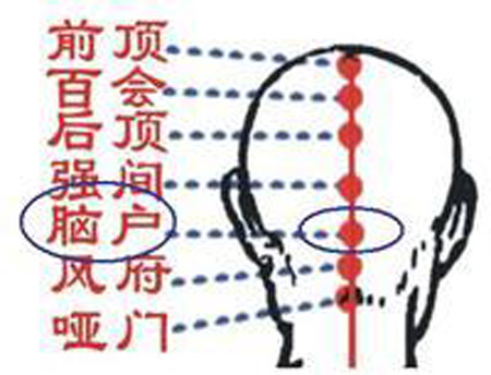 腦戶(hù)穴→治頭重、頭痛