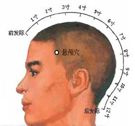 懸顱穴→治偏頭痛、面腫