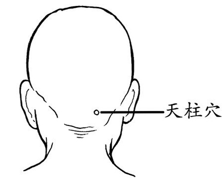 天柱穴→治頭痛、項強