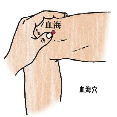 血海穴→治濕疹、丹毒