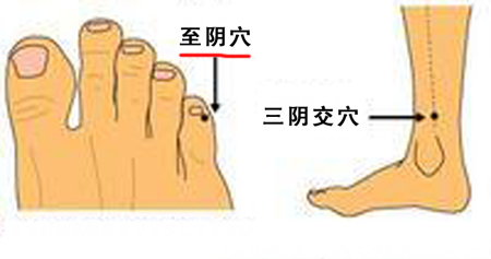至陰穴→治頭痛、目痛