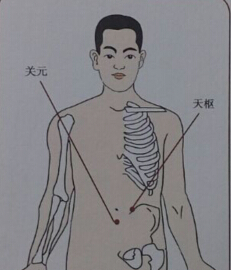 針灸治療便秘哪個穴位？便秘的針灸療法