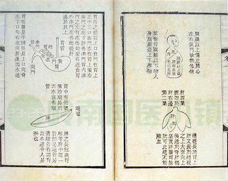 《醫(yī)林改錯(cuò)》書影