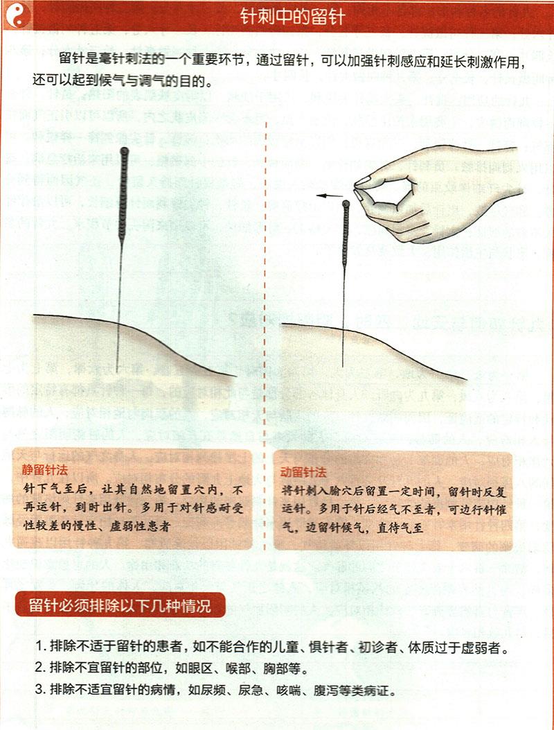 針刺穴位時有哪些需要注意的？