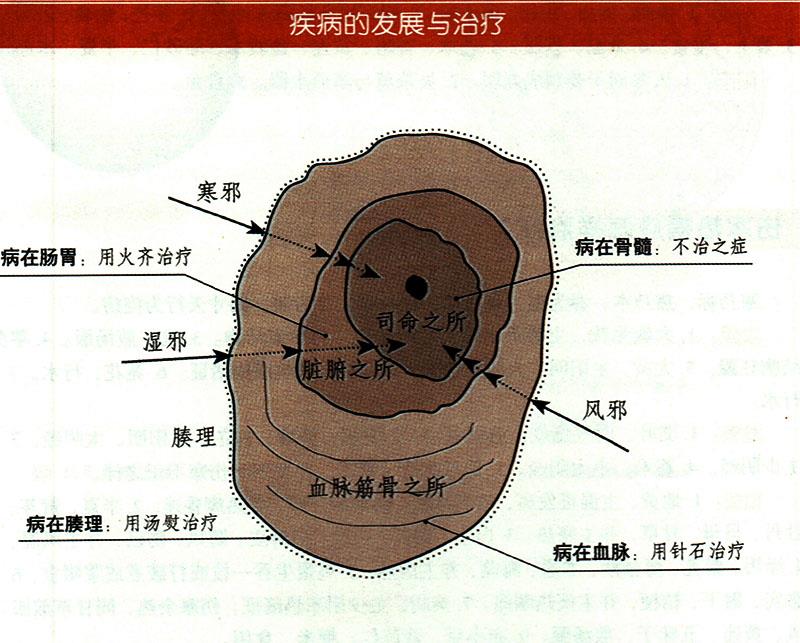 諸氣應(yīng)怎樣治療？