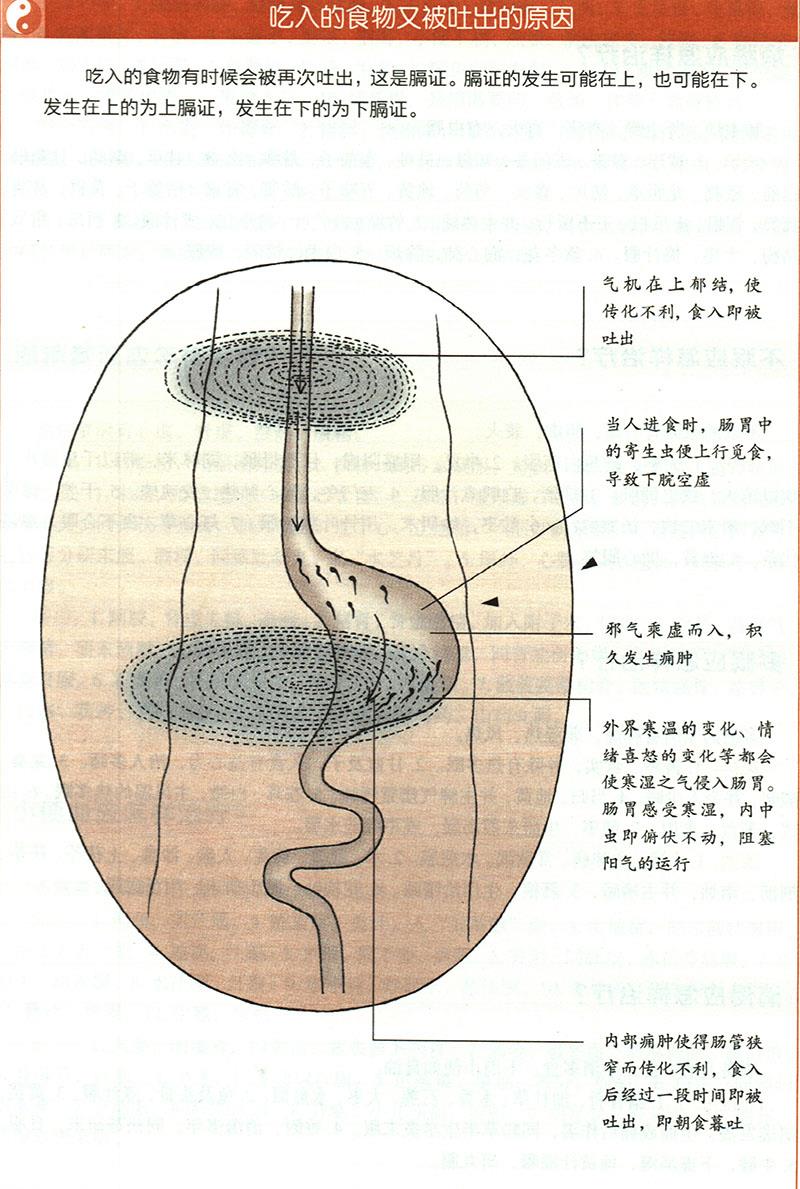 嘔吐應怎樣治療？
