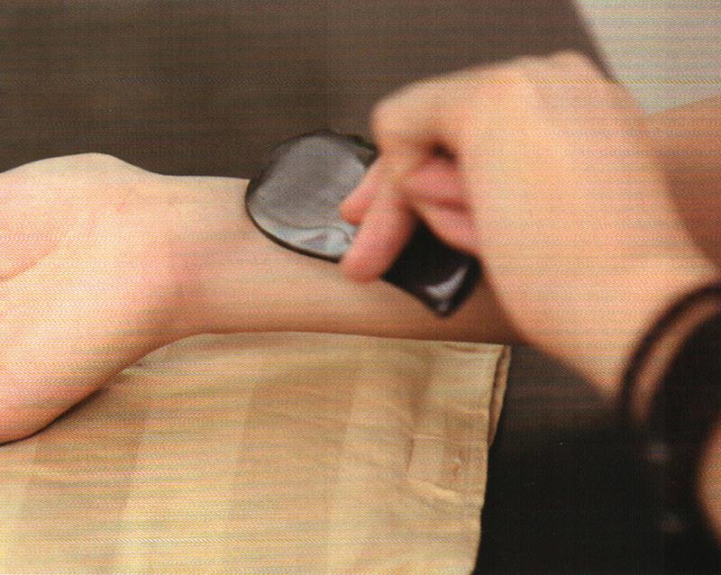 內(nèi)科疾病——肺炎